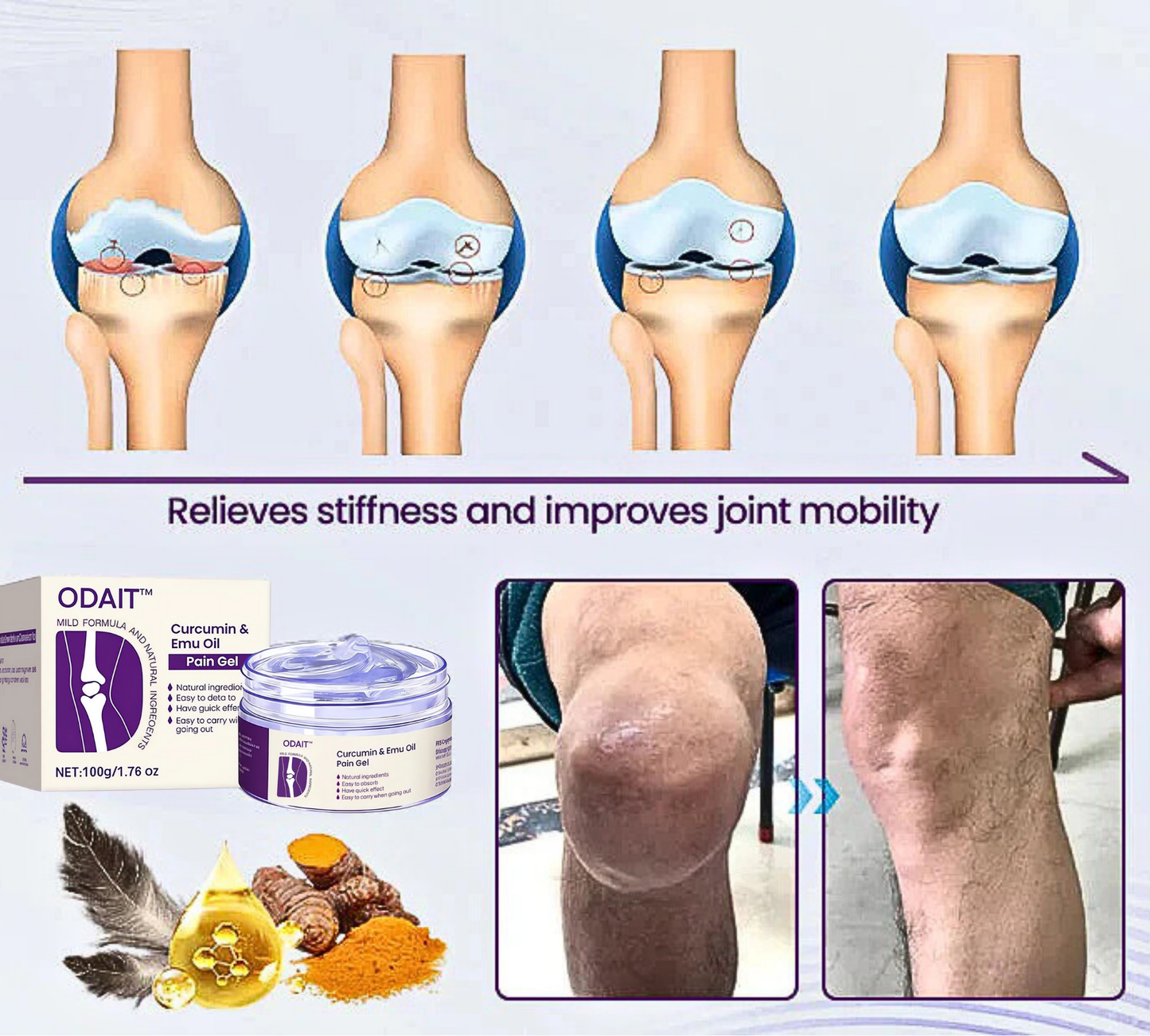 ODAIT⢠Curcumin & Emu Oil Pain Gel-š„Backed by Us Osteopathic Experts