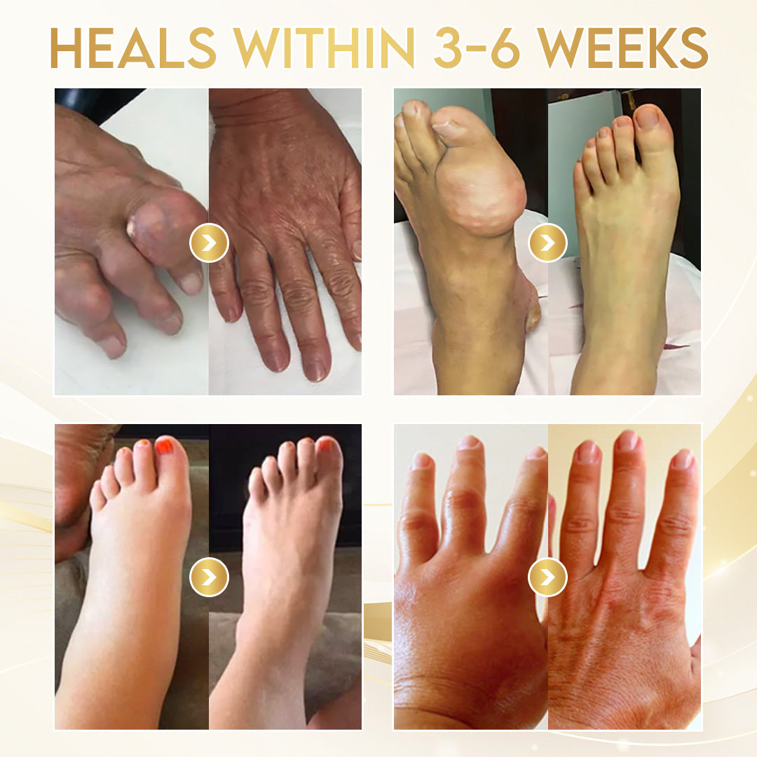 Comfort for Joints ⚡ | Odeiun™ Orthopedic Cream • Bee Venom + Botulinum • AAOS-Inspired