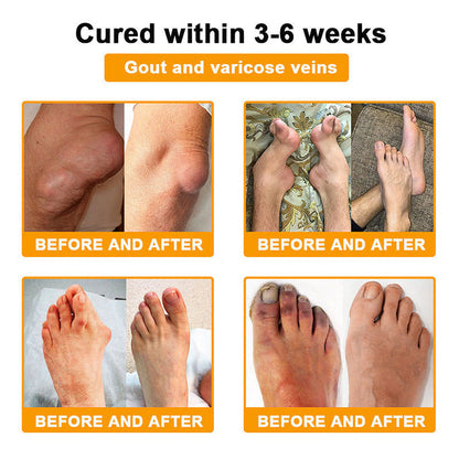 【Last Day Promotion 80% OFF🔥】FDA Official: LBMLBM™ BeeVenom Joint Relief Patch – Arthritis Pain Relief, Anti-Inflammation & Mobility Support（Zero Pain | 24/7 Comfort | Natural Healing）🔥🎁