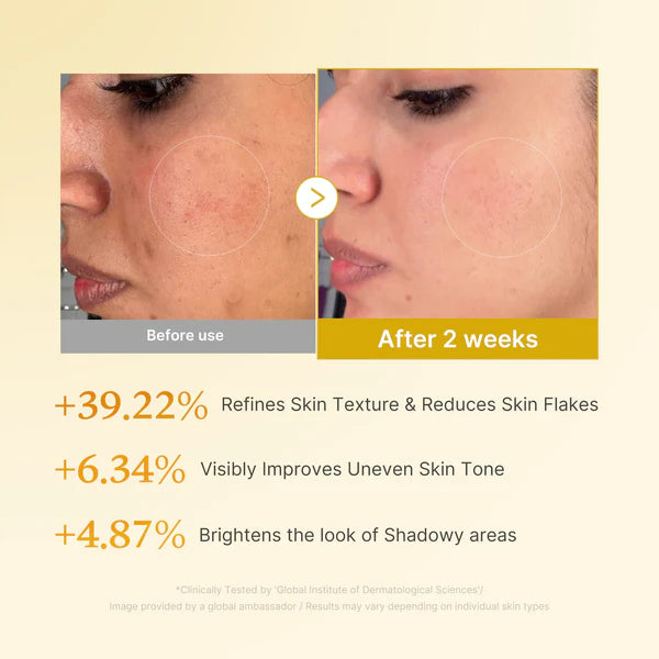 Reveal Brighter, Smoother Skin — Every Shower  Kojic Acid + Turmeric Brightening Body Wash