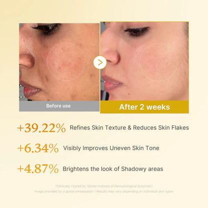 Reveal Brighter, Smoother Skin — Every Shower  Kojic Acid + Turmeric Brightening Body Wash