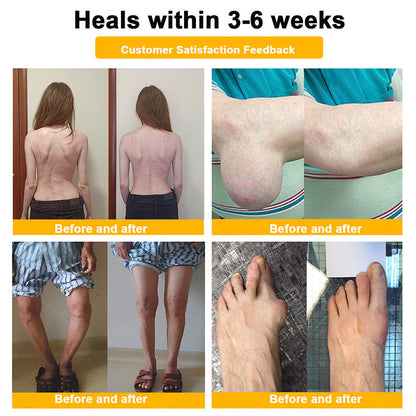 【Last Day Promotion 80% OFF🔥】FDA Official: LBMLBM™ BeeVenom Joint Relief Patch – Arthritis Pain Relief, Anti-Inflammation & Mobility Support（Zero Pain | 24/7 Comfort | Natural Healing）🔥🎁