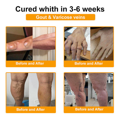 【Last Day Promotion 80% OFF🔥】FDA Official: LBMLBM™ BeeVenom Joint Relief Patch – Arthritis Pain Relief, Anti-Inflammation & Mobility Support（Zero Pain | 24/7 Comfort | Natural Healing）🔥🎁