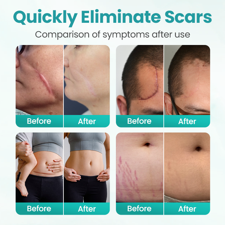 Seurico® EliteAloe ScarSolve Spray