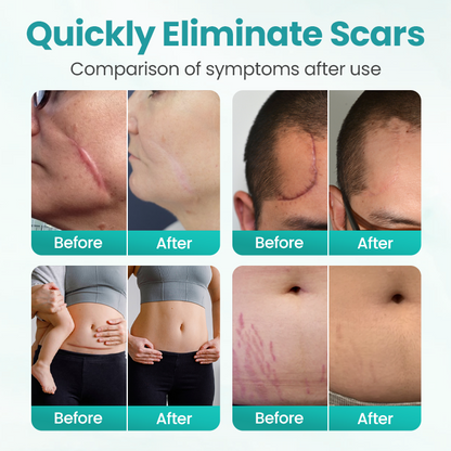 Seurico® EliteAloe ScarSolve Spray