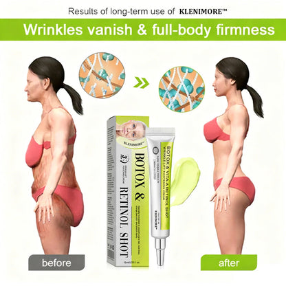 🌟👨‍⚕️Made and shipped from Australia 💫Rolimey® Botox & Vita-A Retinol Shot Wrinkle-Lift Tightening cream - Last Day Promotion 70% OFF