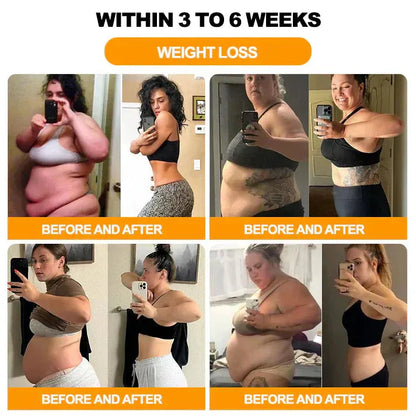 【Last Day Promotion 80% OFF🔥】FDA Official: LBMLBM™ BeeMelittin Slimming Patch – Fat Burning, Cellulite Reduction & Body Shaping（Zero Pain, 24/7 Release | Lose 20lbs FAST | 90% Sugar Drop | ）🔥🎁