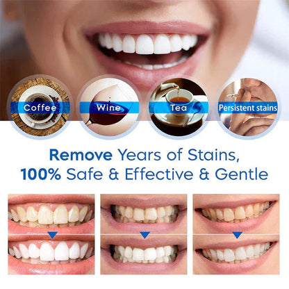 SmileFitPro™ Teeth Whitening Pen