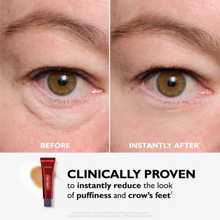 🔥  Last 3 Hours 50% OFF  ✨ BUY 1 GET 1 FREE🔥Eye Bag Eraser — Instantly Refreshes, Firms & Smooths for a Youthful Look That Lasts 8 Hours