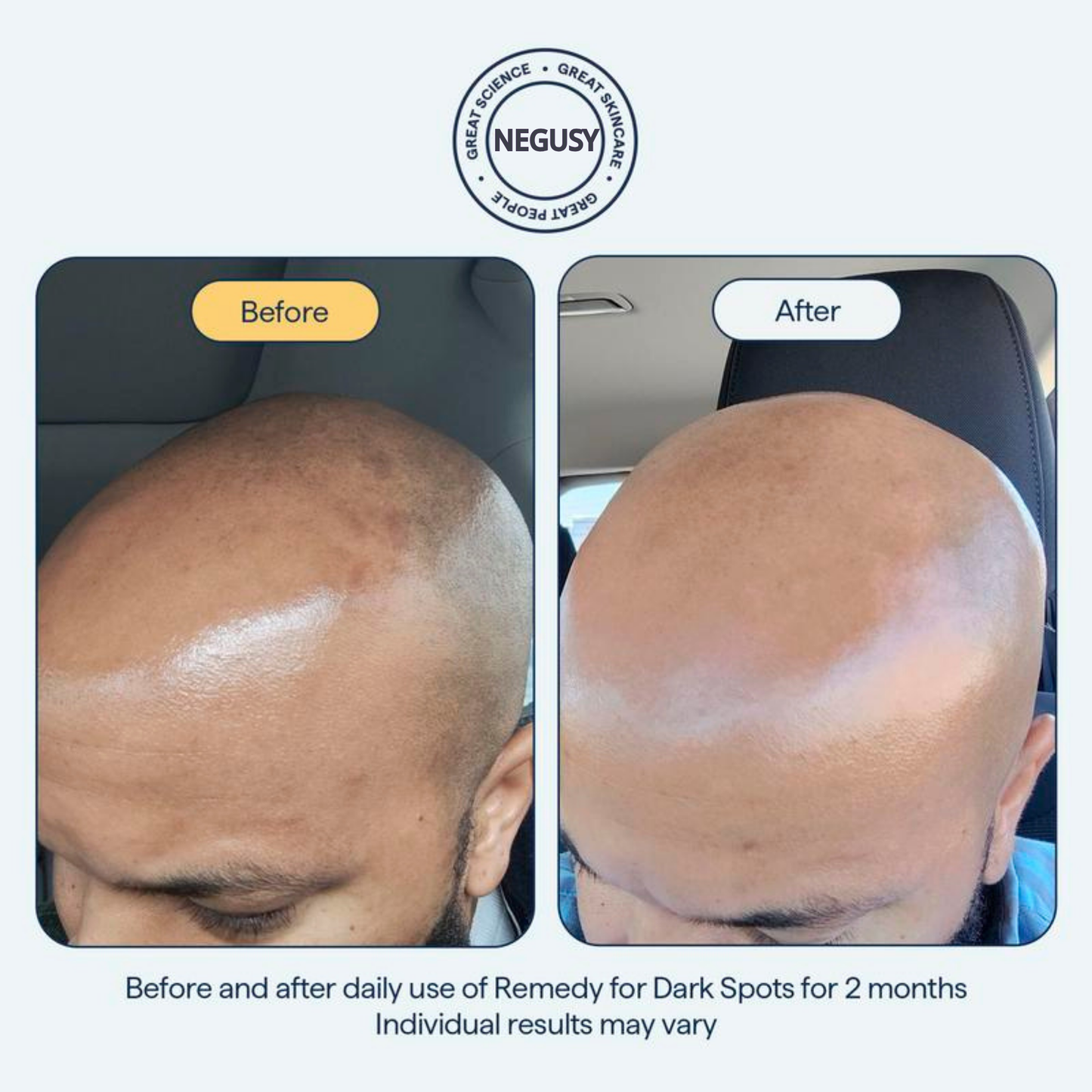 NEGUSY for Dark Spots - All-in-One Nightly Serum for Fading Dark Spots & Evening Skin Tone with Retinol, Kojic Acid & Tranexamic Acid