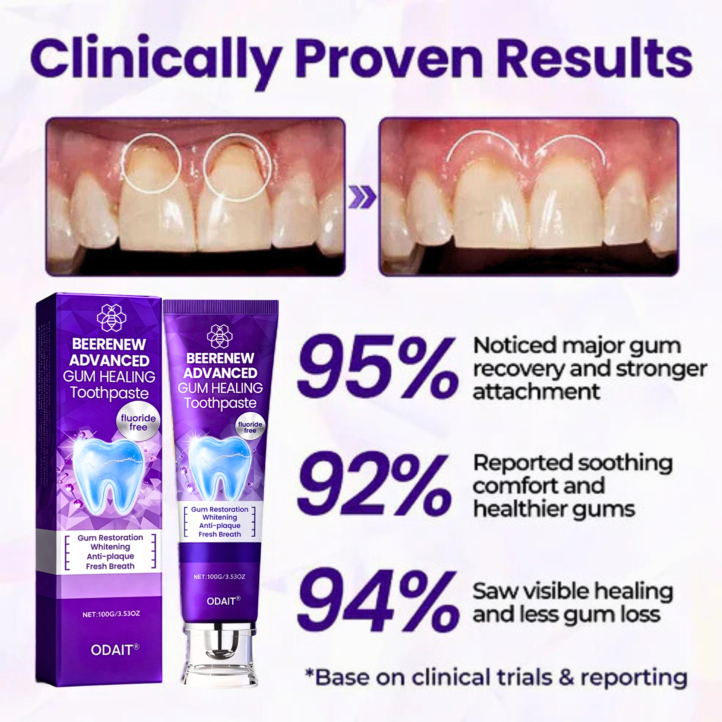 ODAIT® BeeRenew Advanced Gum Healing Toothpaste