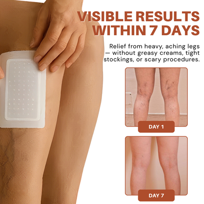 ODALIT® VeinTarget Microneedle Patch – Chlorophyll & Rutin: The 2 Ingredients That Fix Veins for Good