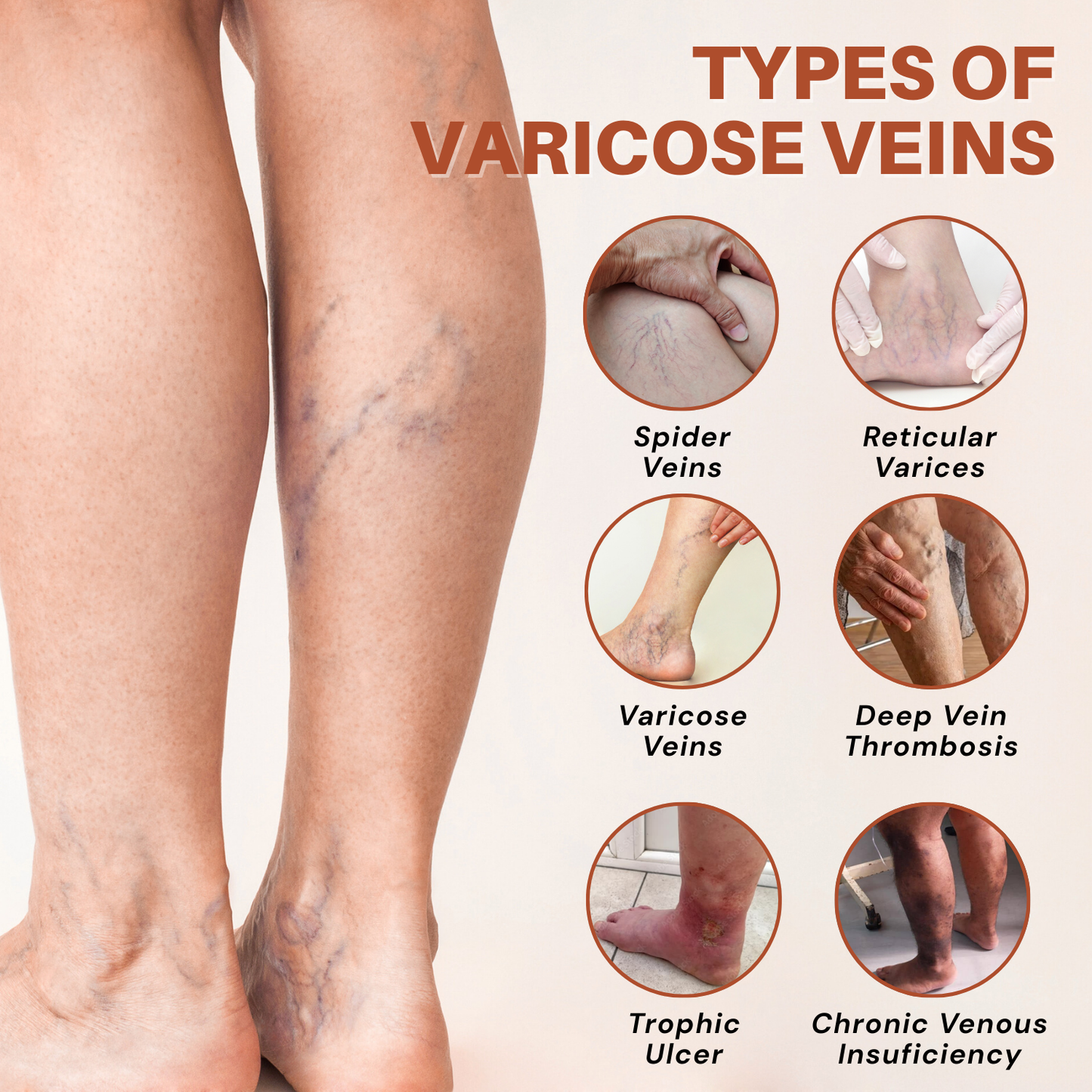 ODALIT® VeinTarget Microneedle Patch – Chlorophyll & Rutin: The 2 Ingredients That Fix Veins for Good