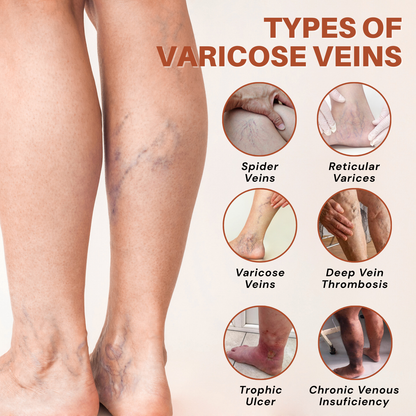 ODALIT® VeinTarget Microneedle Patch – Chlorophyll & Rutin: The 2 Ingredients That Fix Veins for Good