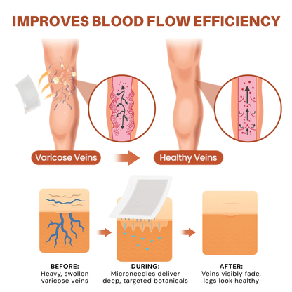 ODALIT® VeinTarget Microneedle Patch – Chlorophyll & Rutin: The 2 Ingredients That Fix Veins for Good