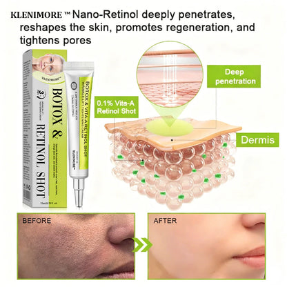 🌟👨‍⚕️Made and shipped from Australia 💫Rolimey® Botox & Vita-A Retinol Shot Wrinkle-Lift Tightening cream - Last Day Promotion 70% OFF