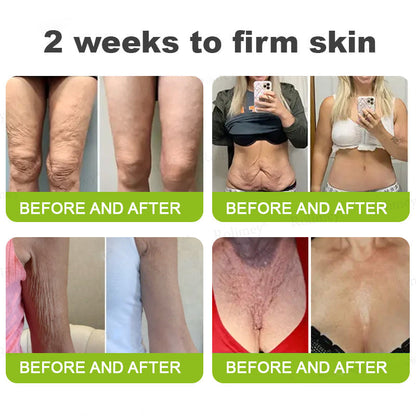 🌟👨‍⚕️Made and shipped from Australia 💫Rolimey® Botox & Vita-A Retinol Shot Wrinkle-Lift Tightening cream - Last Day Promotion 70% OFF