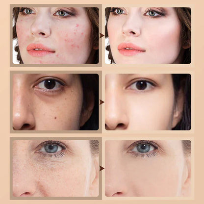 2025 paras värinmuutos kypsän ihon säätiöön