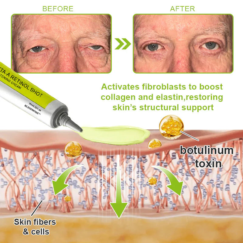 🌟👨‍⚕️Made and shipped from Australia 💫Rolimey® Botox & Vita-A Retinol Shot Wrinkle-Lift Tightening cream - Last Day Promotion 70% OFF