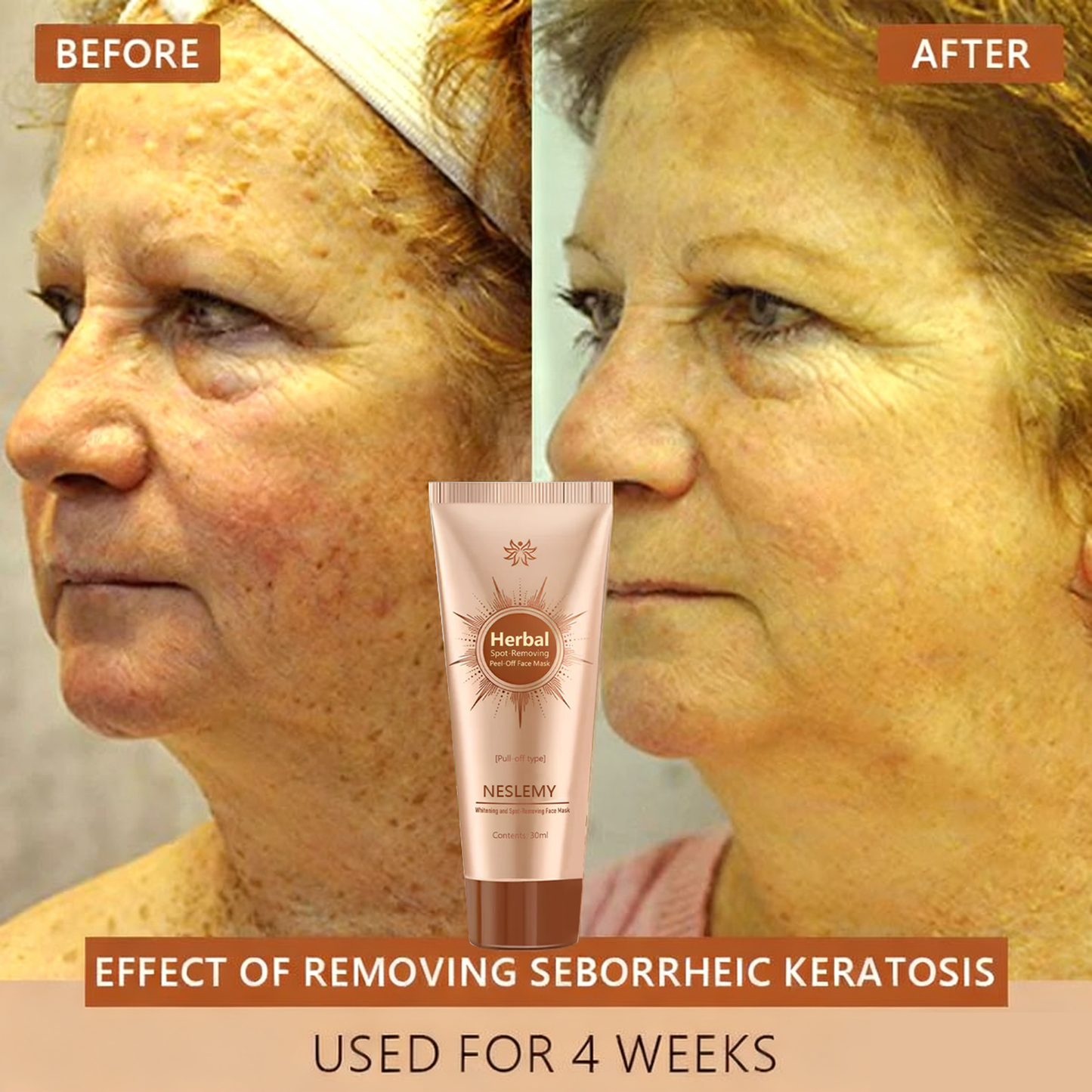 Whitening and Spot-Removing Face Mask Suitable for face and body – 👩‍⚕️ Natural ingredients permanently remove age spots, freckles, sun spots, and liver spots.