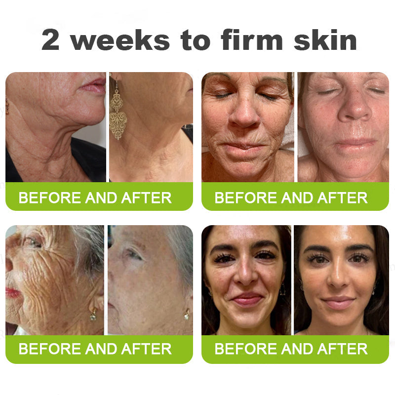 🌟👨‍⚕️Made and shipped from Australia 💫Rolimey® Botox & Vita-A Retinol Shot Wrinkle-Lift Tightening cream - Last Day Promotion 70% OFF