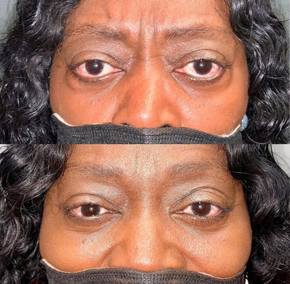 💥Hot Listing 🔥Eye Bag Eraser Instant Anti-Aging Cream--Erase Eye Bags, Wrinkles & Puffiness in an Instant