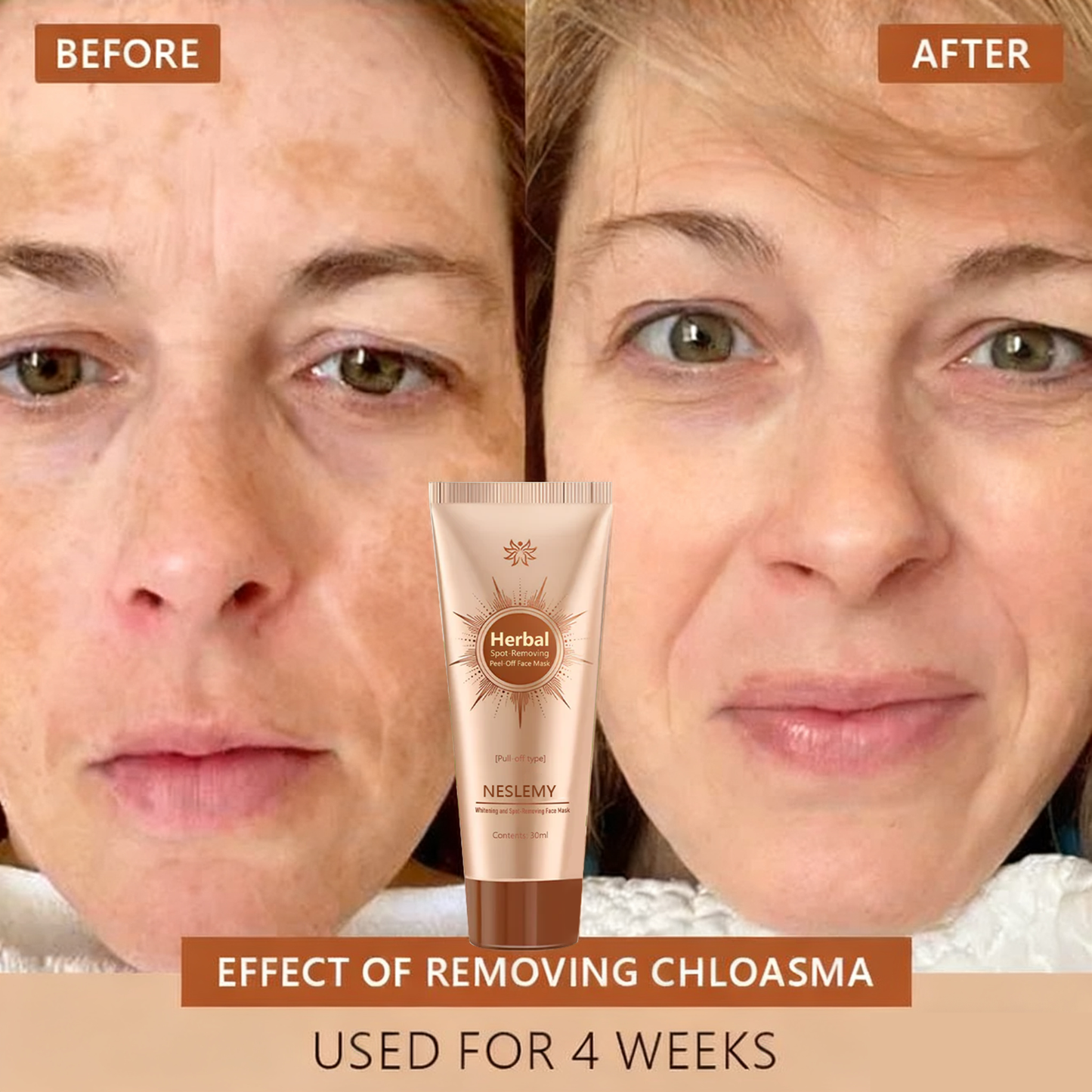 Whitening and Spot-Removing Face Mask Suitable for face and body – 👩‍⚕️ Natural ingredients permanently remove age spots, freckles, sun spots, and liver spots.