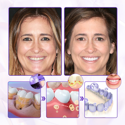 ODAIT® BeeRenew Advanced Gum Healing Toothpaste