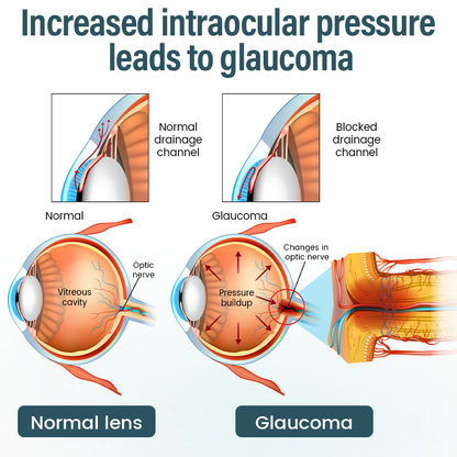 𝗧𝗶𝗺𝗹𝗹𝗸® OptiFusion Nano Eye Drops Serum - Nano-Technology Eye Drops for Root Cause Vision Repair