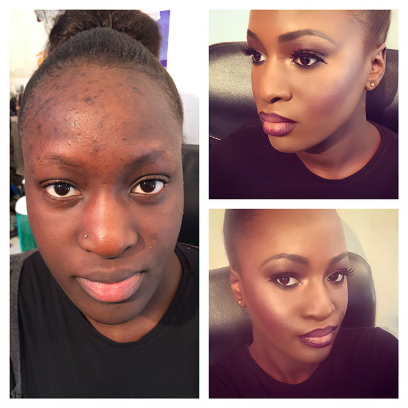 2025 paras värinmuutos kypsän ihon säätiöön