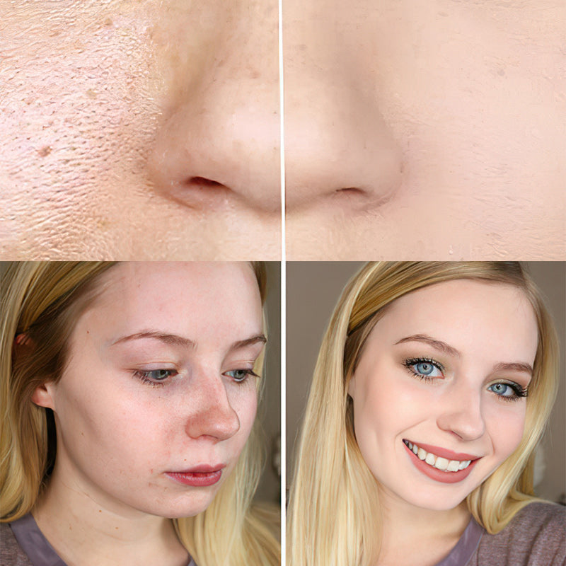 2025 paras värinmuutos kypsän ihon säätiöön