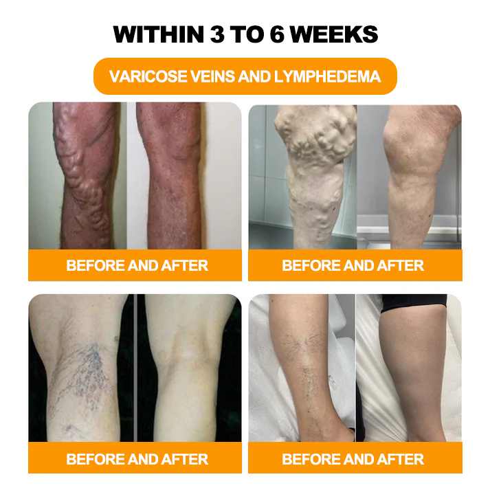 Seurico™ Herbal VenoDetox Foot Bath Beads (𝐋𝐀𝐍𝐀 𝐂𝐞𝐫𝐭𝐢𝐟𝐢𝐜𝐚𝐭𝐢𝐨𝐧，𝗟𝘆𝗺𝗽𝗵𝗮𝘁𝗶𝗰 𝗔𝘀𝘀𝗼𝗰𝗶𝗮𝘁𝗶𝗼𝗻 𝗼𝗳 𝗔𝗺𝗲𝗿𝗶𝗰𝗮)