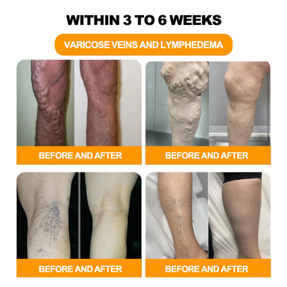 Seurico™ Herbal VenoDetox Foot Bath Beads (𝐋𝐀𝐍𝐀 𝐂𝐞𝐫𝐭𝐢𝐟𝐢𝐜𝐚𝐭𝐢𝐨𝐧，𝗟𝘆𝗺𝗽𝗵𝗮𝘁𝗶𝗰 𝗔𝘀𝘀𝗼𝗰𝗶𝗮𝘁𝗶𝗼𝗻 𝗼𝗳 𝗔𝗺𝗲𝗿𝗶𝗰𝗮)