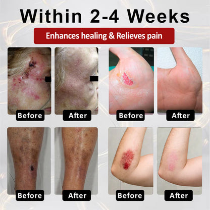 ATFDX® GlucoseGuard Skin Rescue Cream