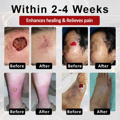 ATFDX® GlucoseGuard Skin Rescue Cream