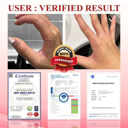 ATFDX® GlucoseGuard Skin Rescue Cream