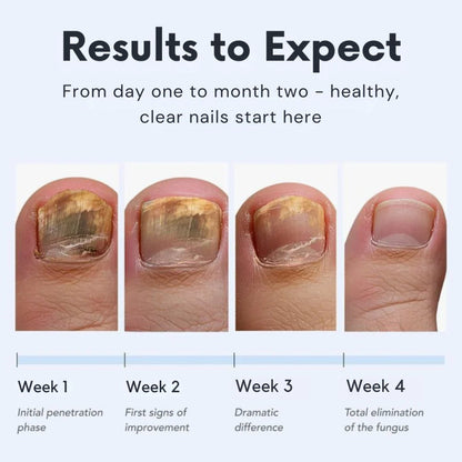 Curvyify™ Antifungal Pen