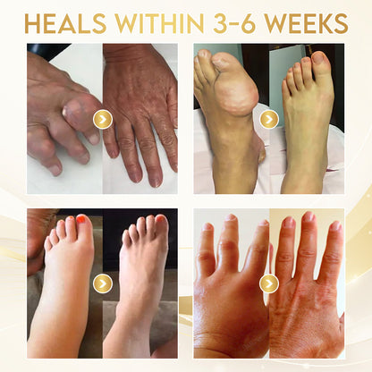 Comfort for Joints ⚡ | Odeiun™ Orthopedic Cream • Bee Venom + Botulinum • AAOS-Inspired