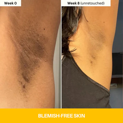 Reveal Brighter, Smoother Skin — Every Shower  Kojic Acid + Turmeric Brightening Body Wash