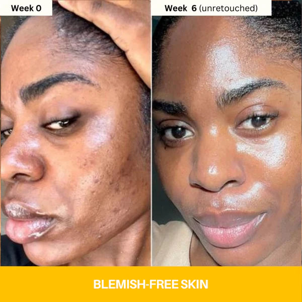 Reveal Brighter, Smoother Skin — Every Shower  Kojic Acid + Turmeric Brightening Body Wash