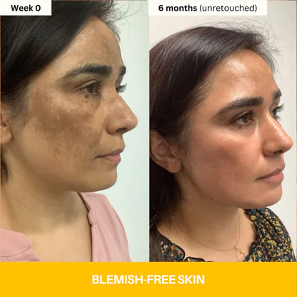 Reveal Brighter, Smoother Skin — Every Shower  Kojic Acid + Turmeric Brightening Body Wash