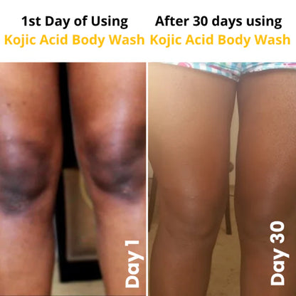 Reveal Brighter, Smoother Skin — Every Shower  Kojic Acid + Turmeric Brightening Body Wash