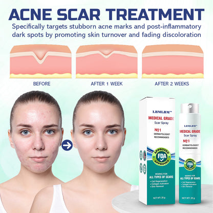 🔥LBMLBM™ Advanced Scar Repair Spray —See Results in 4 Weeks! ✨🩹