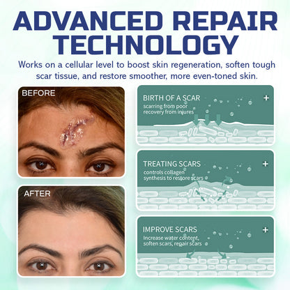 🔥LBMLBM™ Advanced Scar Repair Spray —See Results in 4 Weeks! ✨🩹