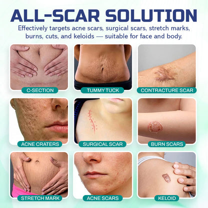 🔥LBMLBM™ Advanced Scar Repair Spray —See Results in 4 Weeks! ✨🩹