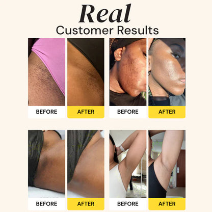 Reveal Brighter, Smoother Skin — Every Shower  Kojic Acid + Turmeric Brightening Body Wash