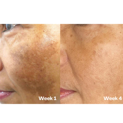 Reveal Brighter, Smoother Skin — Every Shower  Kojic Acid + Turmeric Brightening Body Wash