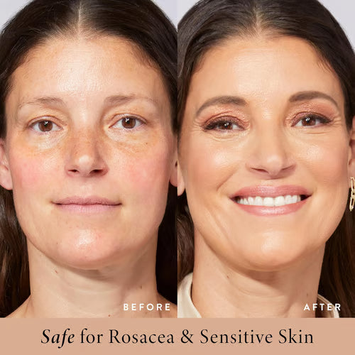 🔥BB Moisturizer SPF 30 – Brighten, Hydrate & Smooth Naturally