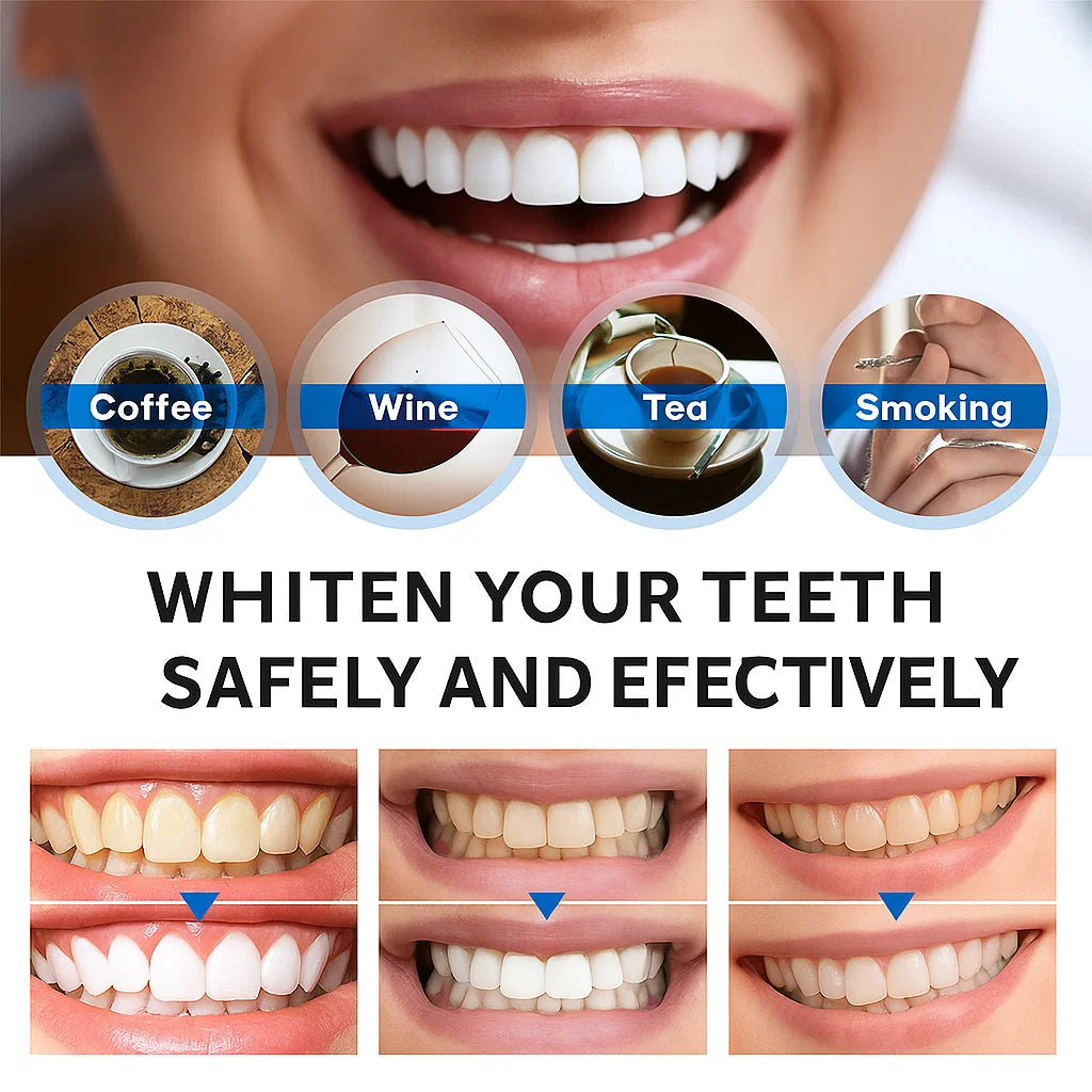 Instant Bright Teeth Whitening Essence Pen – Gentle & Sensitivity-Free (Copy)