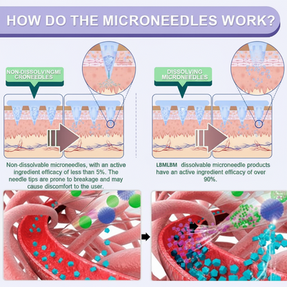 LBMLBM™ NIDDK-Tirzepatide Slimming & health NANO MICRONEEDLE PATCH